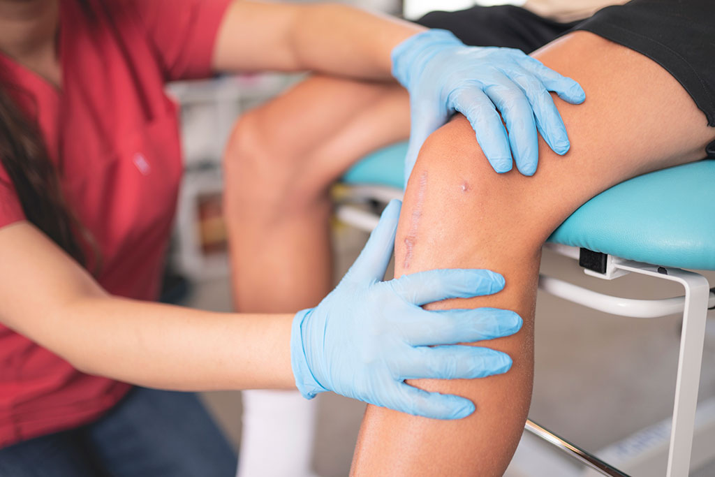 Chelsea Knee