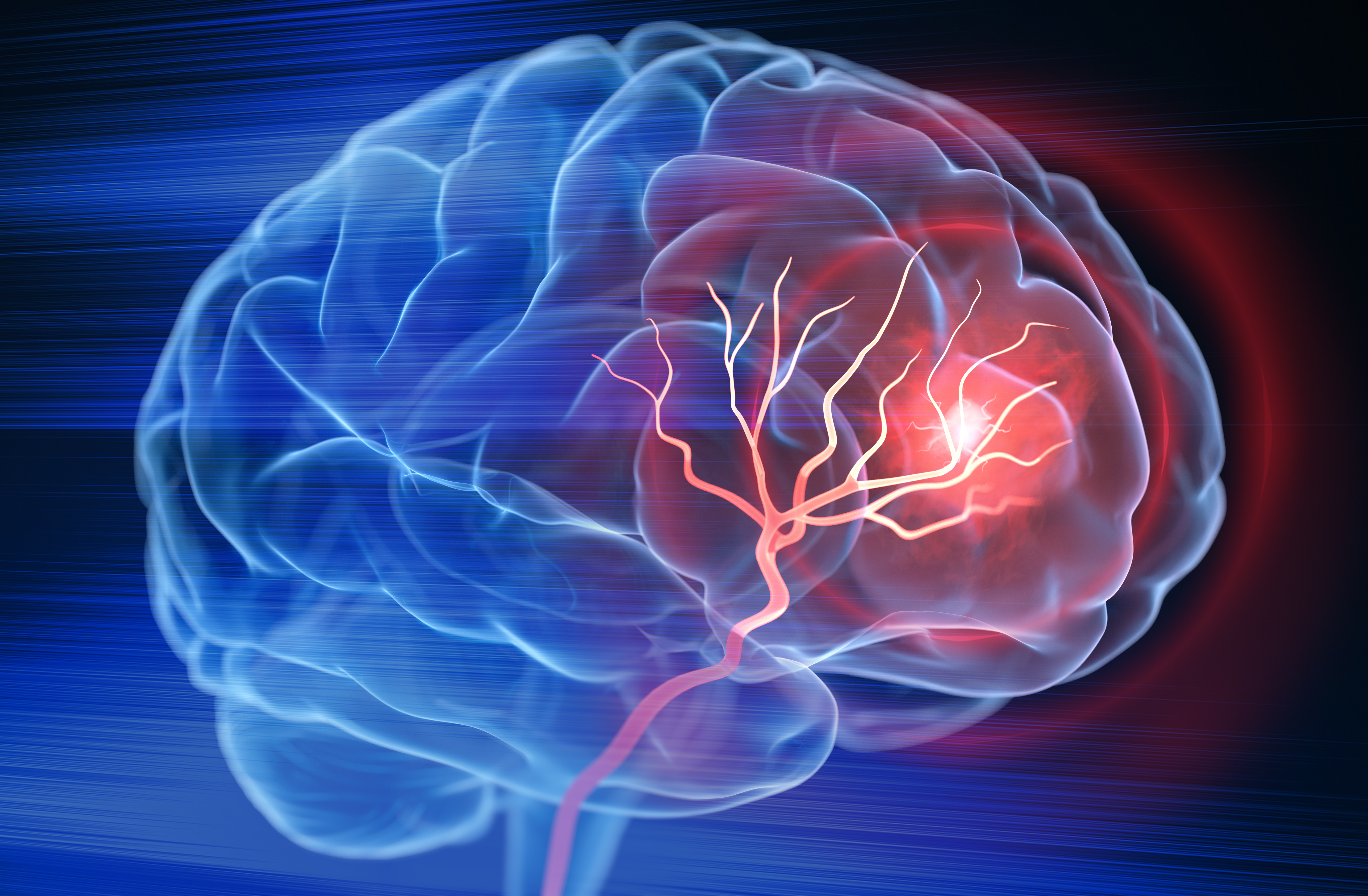 human brain with identified area of trauma
